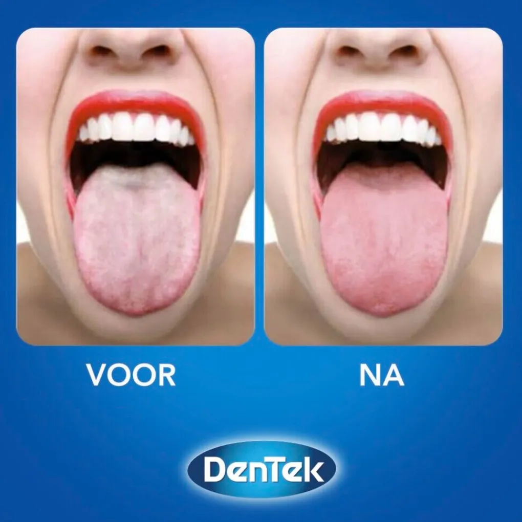 Dentek Tongreinigers>Orabrush 2-in-1 Tongreiniger