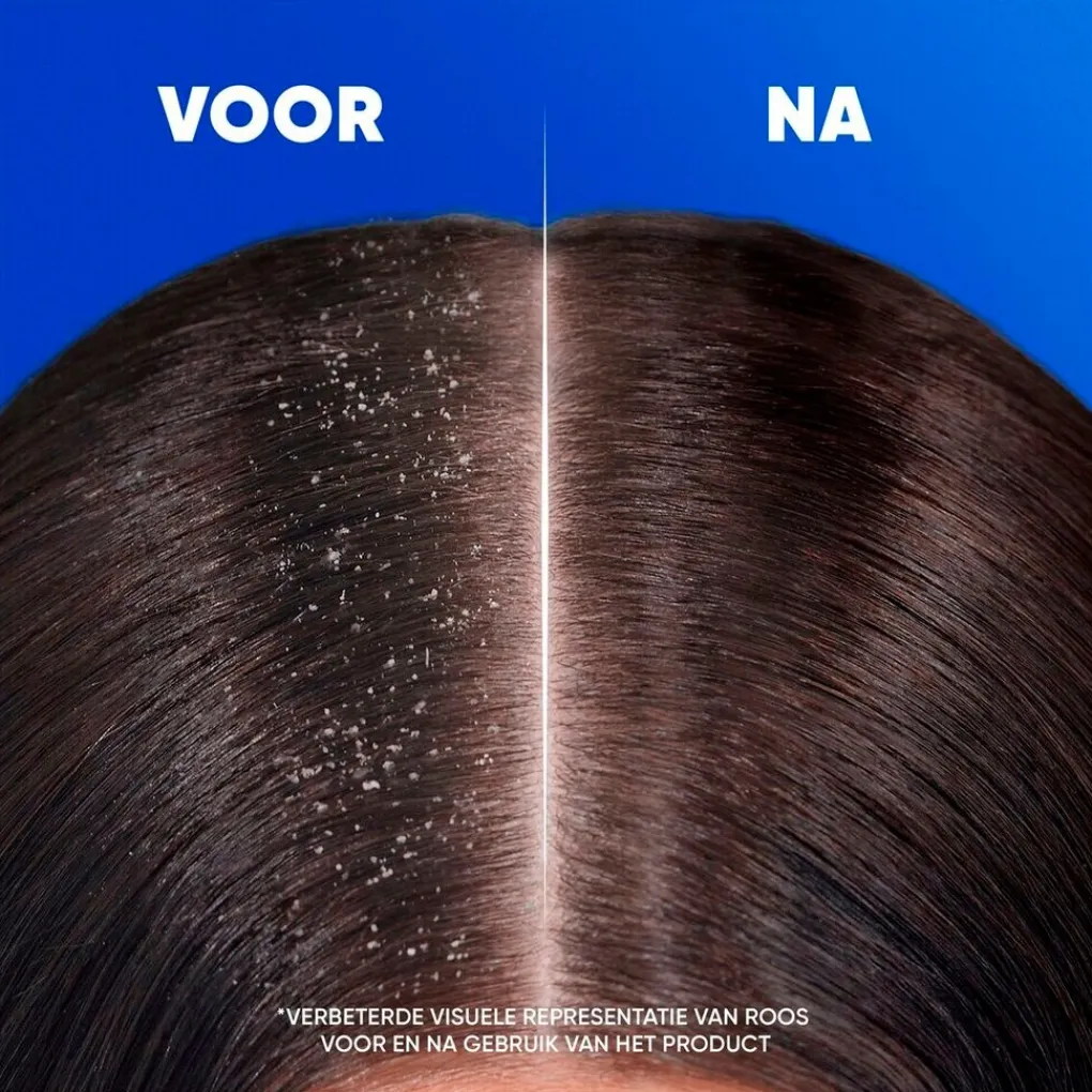 Head & Shoulders Shampoo>Anti-Haaruitval Antiroosshampoo