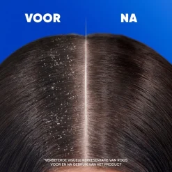 Head & Shoulders Shampoo><noscript><img width=