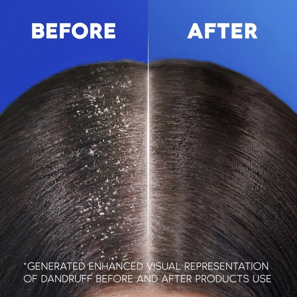 Head & Shoulders Shampoo>Classic Shampoo met Pomp