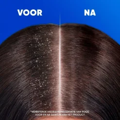Head & Shoulders Shampoo|Conditioner><noscript><img width=