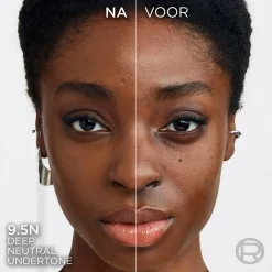 L'Oreal Foundation><noscript><img width=