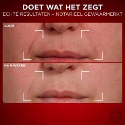 L'Oreal Paris Dagcreme><noscript><img width=