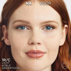 L'Oreal Gezichtspoeder><noscript><img width=