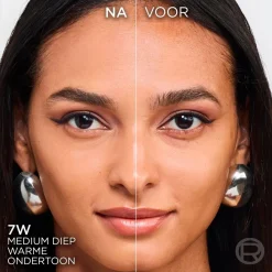 L'Oreal Foundation><noscript><img width=