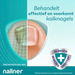 Nailner Kalknagels><noscript><img width=