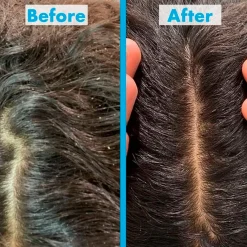 Umberto Giannini Haartreatment><noscript><img width=